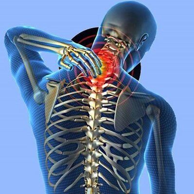 颈部疼痛与颈骨软骨病