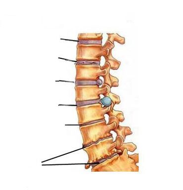 骨软骨病的发展方式