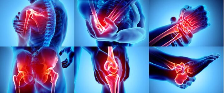 发炎的关节